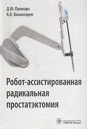 Робот-ассистированная радикальная простатэктомия
