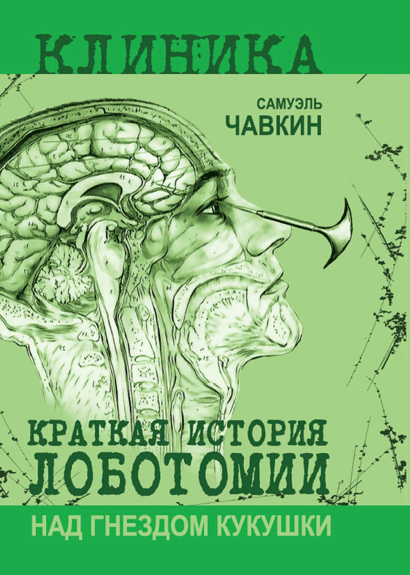 Обложка книги «Над гнездом кукушки. Краткая история лоботомии»