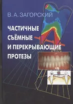 Частичные съемные и перекрывающие протезы. Морфология и ультраструктура