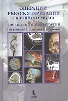 Операции реваскуляризации головного мозга в сосудистой нейрохирургии, цв. илл.