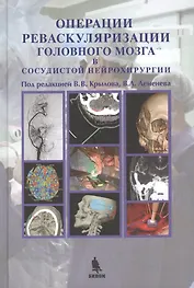 Операции реваскуляризации головного мозга в сосудистой нейрохирургии, цв. илл.