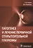 Патогенез и лечение первичной открытоугольной глаукомы. Руководство для врачей - 0