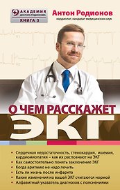 О чем расскажет ЭКГ
