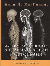Лучевая диагностика в травматологии и ортопедии
