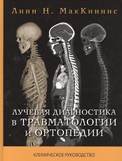 Лучевая диагностика в травматологии и ортопедии