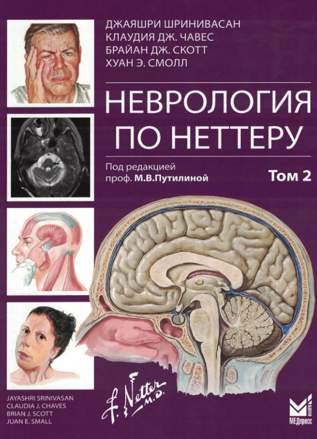 

Неврология по Неттеру. Том 2