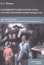 Резекция верхушек корней зубов - лечение периапикальных процессов