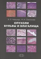 Опухоли вульвы и влагалища