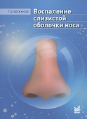 Воспаление слизистой оболочки носа - 0