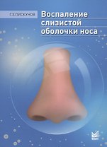 Воспаление слизистой оболочки носа
