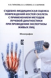 Судебно-медицинская оценка повреждений костей скелета с применением методов лучевой диагностики при проведении экспертизы живых лиц. Монография
