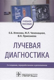 Лучевая диагностика