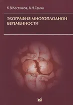 Эхография многоплодной беременности