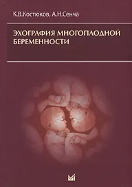 Эхография многоплодной беременности