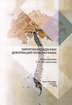 Хирургия врожденных деформаций позвоночника