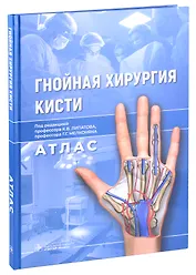 Гнойная хирургия кисти. Атлас