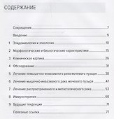 Рак мочевого пузыря. Краткий справочник - 1