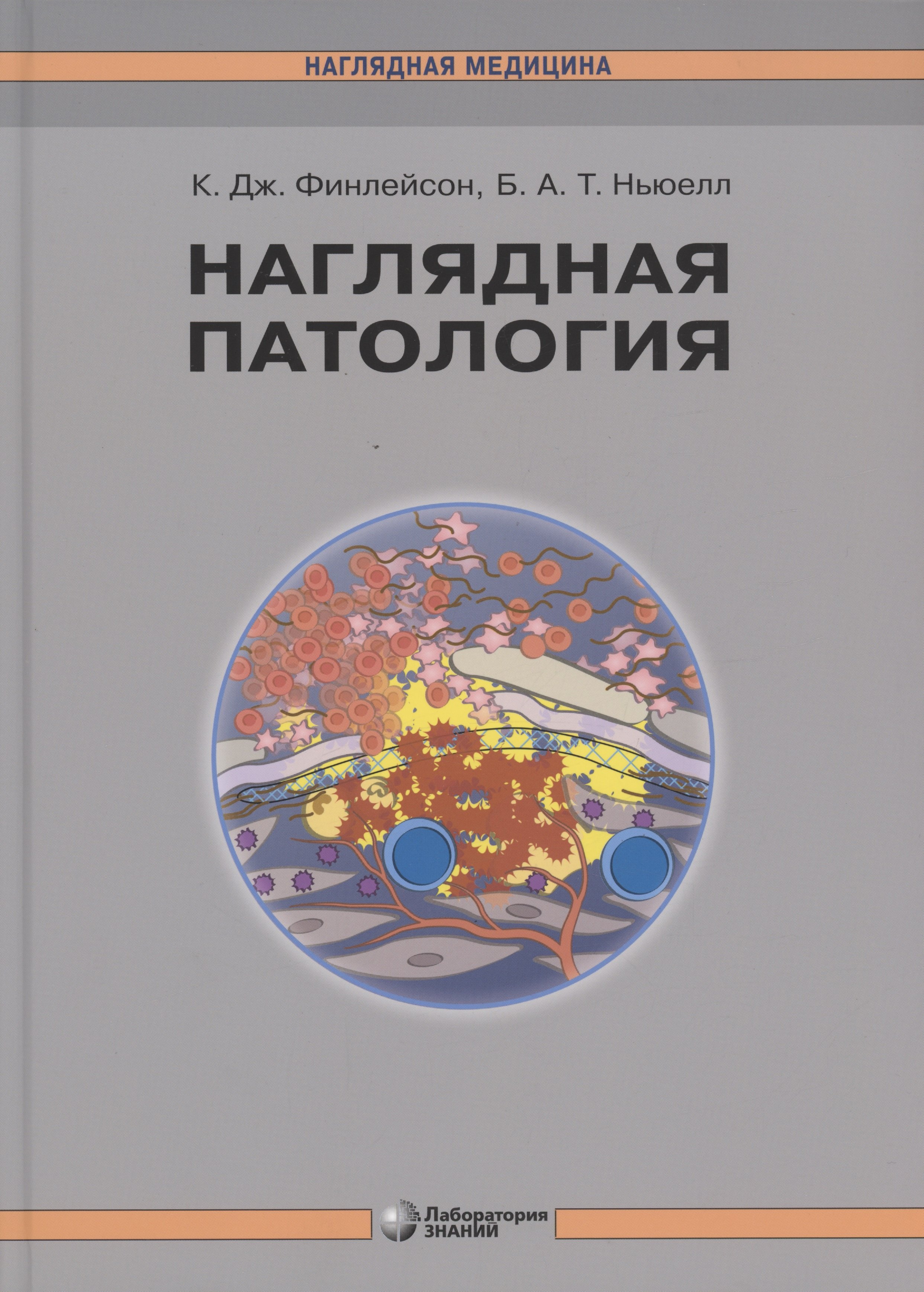 

Наглядная патология