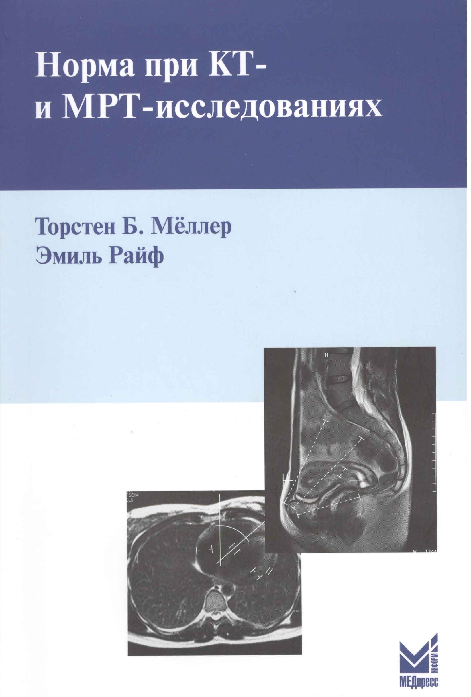 

Норма при КТ - и МРТ - исследованиях