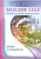 Болезни глаз: причины, лечение, профилактика. Мифы и реальность