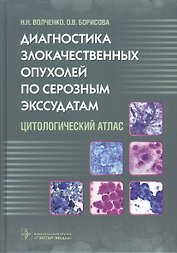 Диагностика злокачественных опухолей по серозным экссудатам.