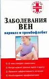 Заболевания вен: варикоз и тромбофлебит