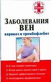 Заболевания вен: варикоз и тромбофлебит