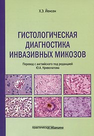Гистологическая диагностика инвазивных микозов