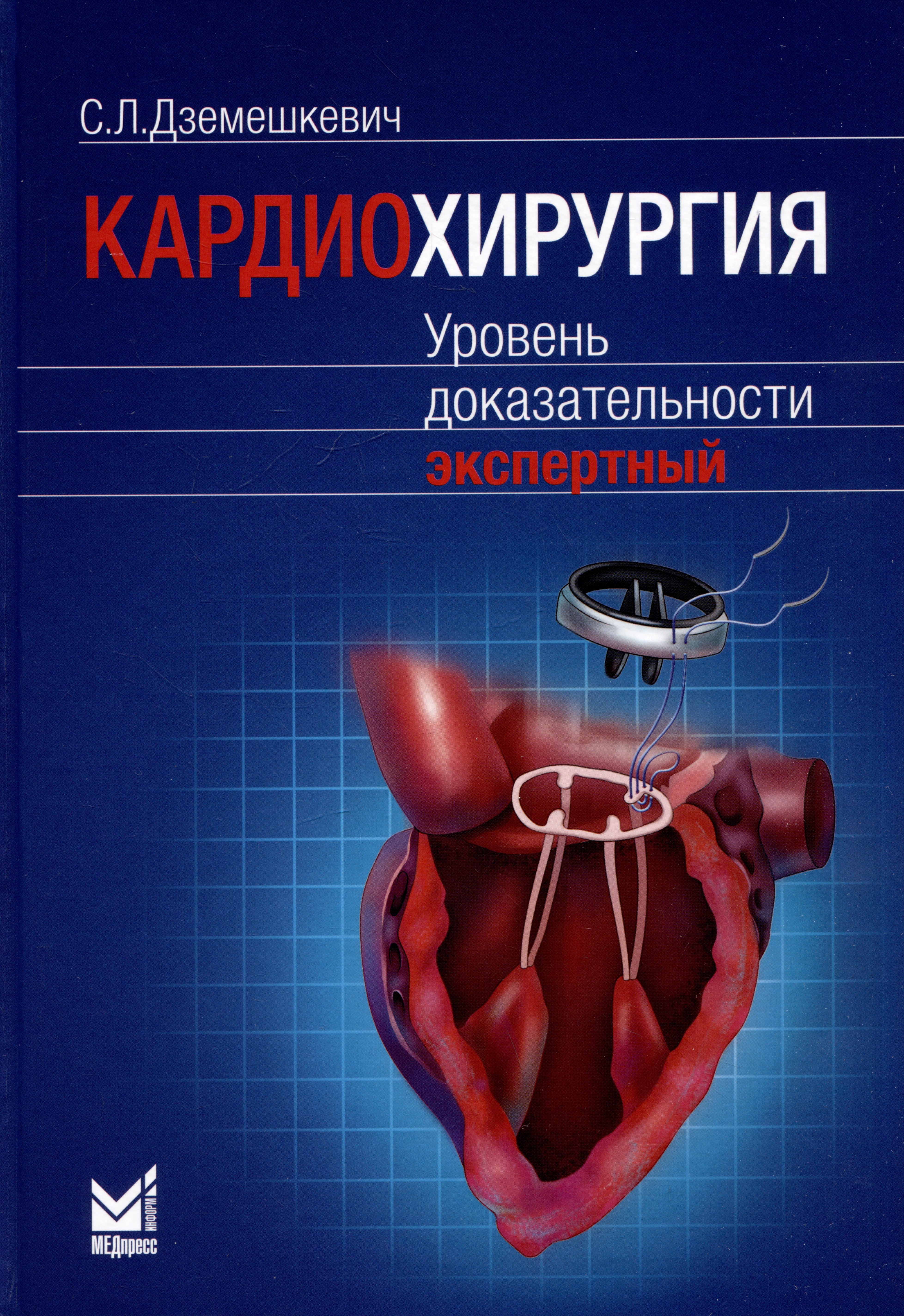 

Кардиохирургия. Уровень доказательности экспертный
