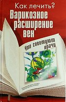 Варикозное расширение вен. Что советуют врачи