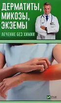 Дерматиты микозы экземы Лечение без химии
