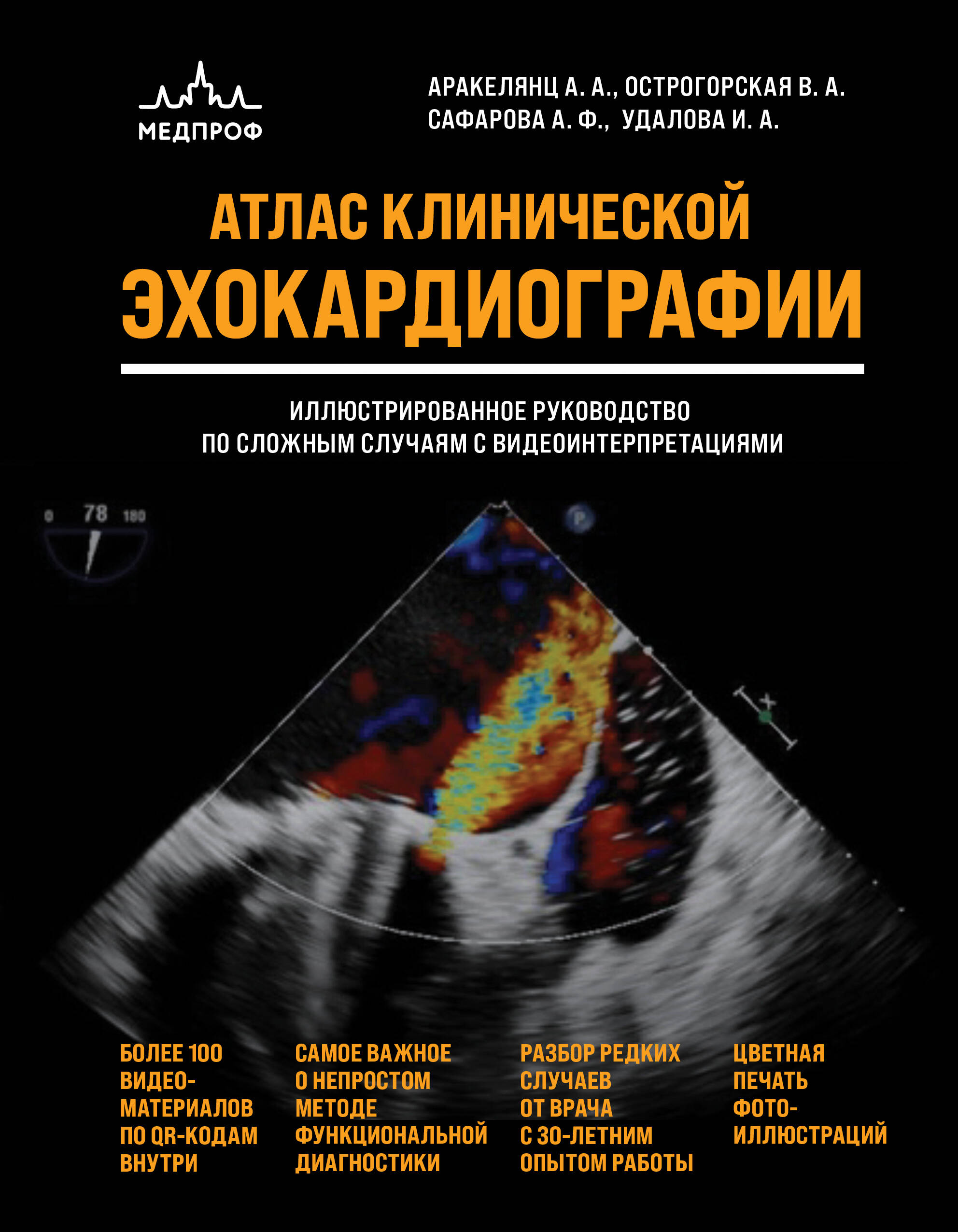 Обложка книги «Атлас ЭхоКГ. Иллюстрированное руководство по сложным случаям с видеоинтерпретациями»