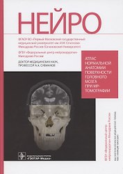 Атлас нормальной анатомии поверхности головного мозга при МР-томографии