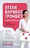 Отеки, варикоз, тромбоз и другие болезни вен. Как лечить и предотвратить - 0