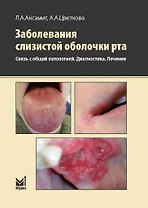 Заболевания слизистой оболочки рта. Связь с общей патологией. Диагностика. Лечение