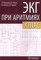 ЭКГ при аритмиях Атлас (+линейка электрокардиографическая) (м) Колпаков