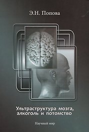 Ультраструктура мозга, алкоголь и потомство