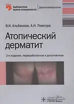 Атопический дерматит