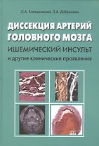 Диссекция артерий головного мозга. Ишемический инсульт и другие клинические проявления