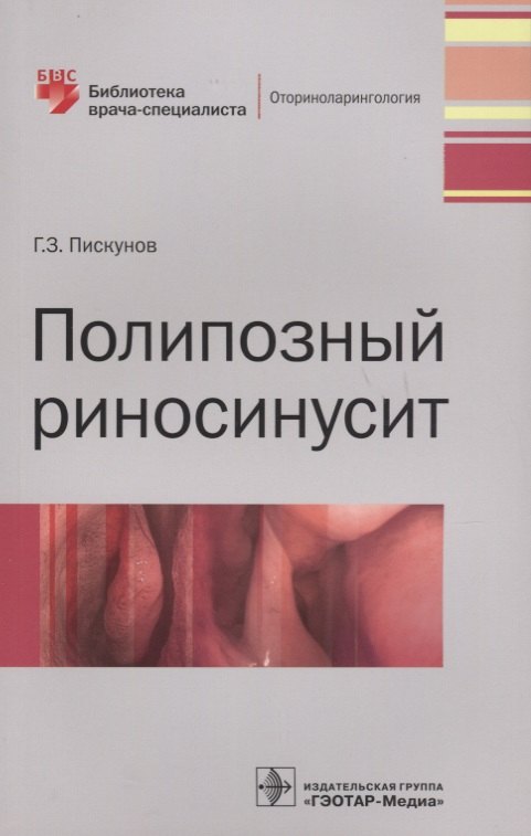 

Полипозный риносинусит