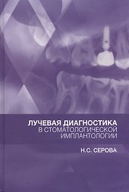 Лучевая диагностика в стоматологической имплантологии