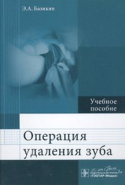 Операция удаления зуба.