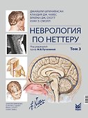 Неврология по Неттеру: В 3-х томах. Том 3 - 0