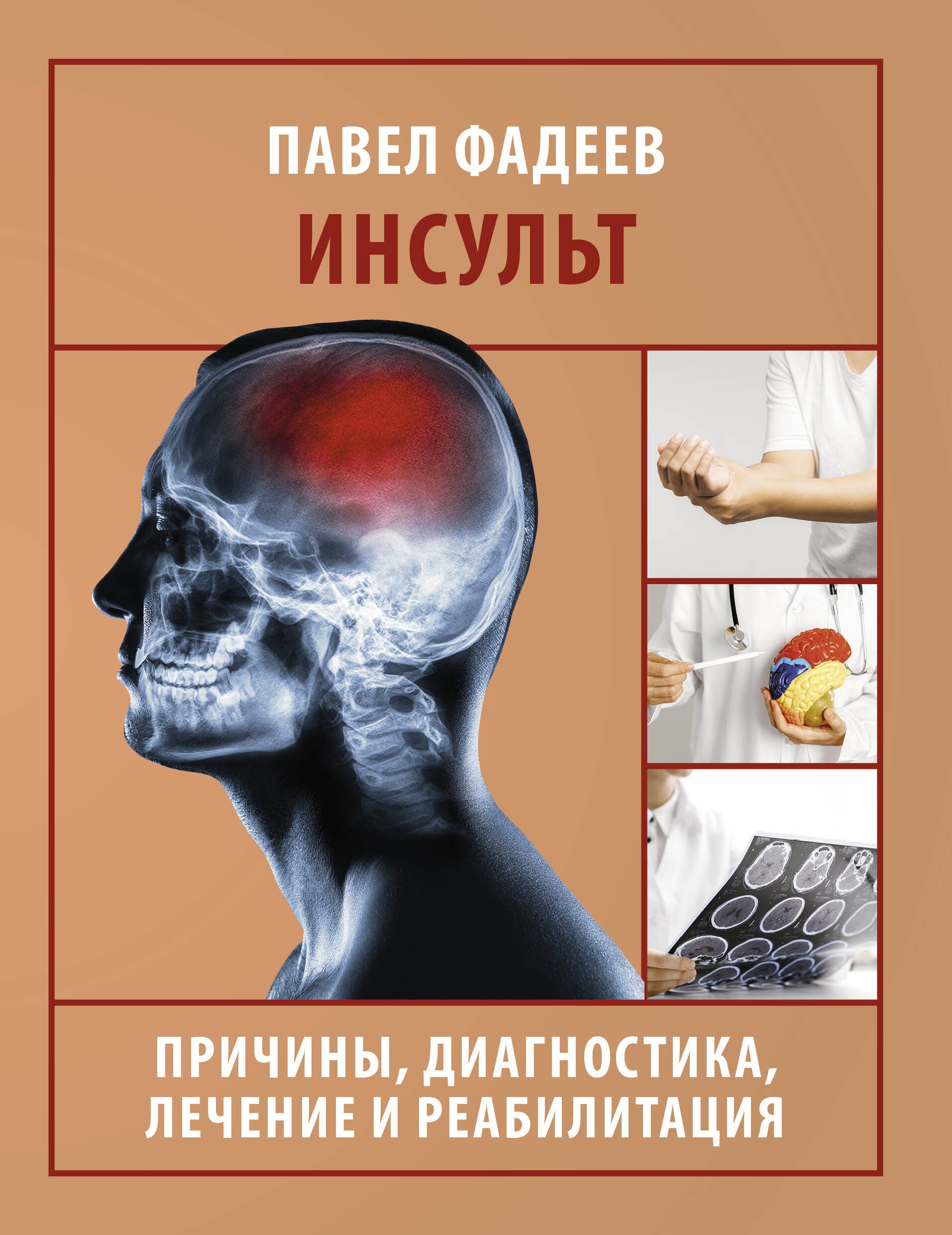 

Инсульт. Причины, диагностика, лечение и реабилитация