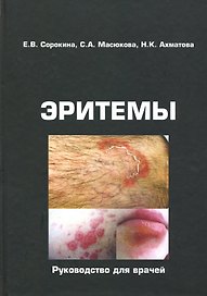 Эритемы. Руководство для врачей