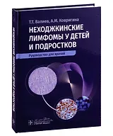 Неходжкинские лимфомы у детей и подростков: руководство для врачей