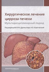 Хирургическое лечение цирроза печени. Мультидисциплинарный подход. Монография