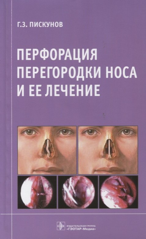 

Перфорация перегородки носа и ее лечение.