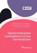 Эндопротезирование тазобедренного сустава при коксартрозе - 0