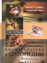 Минимально инвазивные вмешательства в ортопедии: в 2-х томах. Том 1